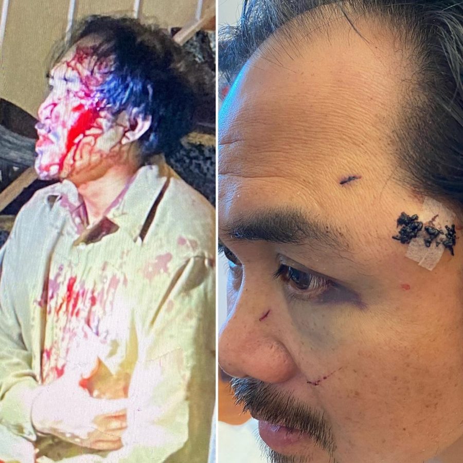 Asian Man Stabbed 5 Times in San Francisco - Asian Dawn Man Got Stabbed In The Lung And Still Won