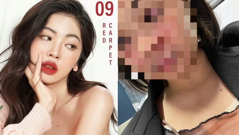 Thai Model Severely Beaten After Moving to NYC